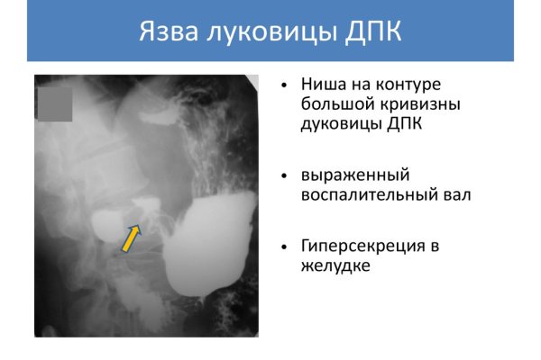 Как зайти на кракен даркнет